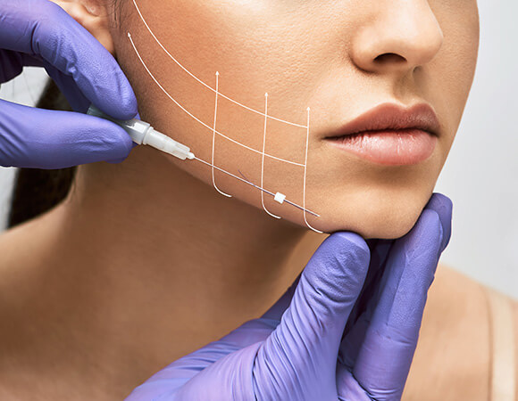 Benefits of PDO Thread Lifts at MediZen Institute