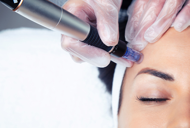 Woman getting an VirtueRF Microneedling at MediZen Institute