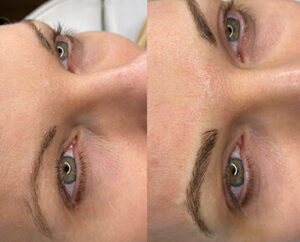 Before and after Brow Microblading